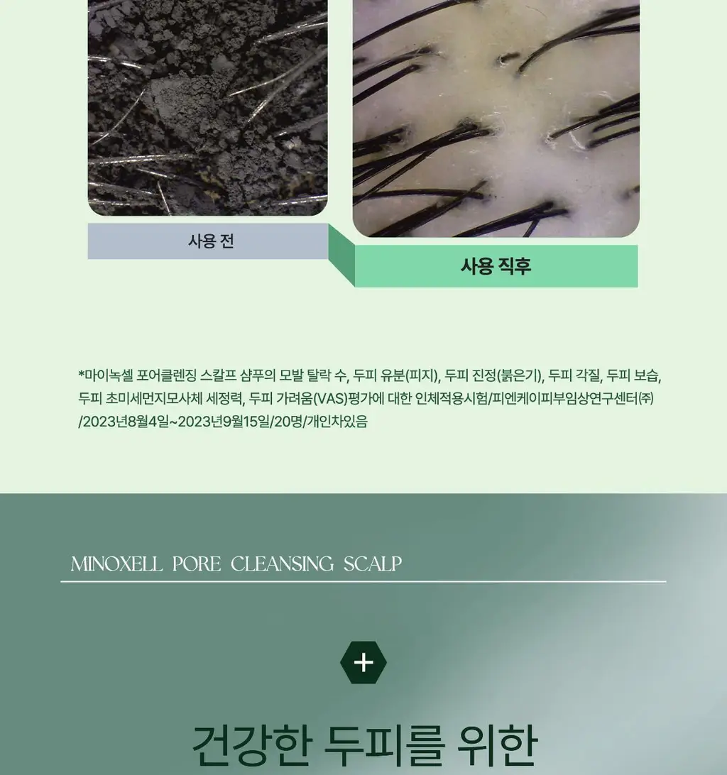 [허경환 PICK/현대약품특허]마이녹셀 포어클렌징 스칼프 샴푸 480ml 상세페이지 20